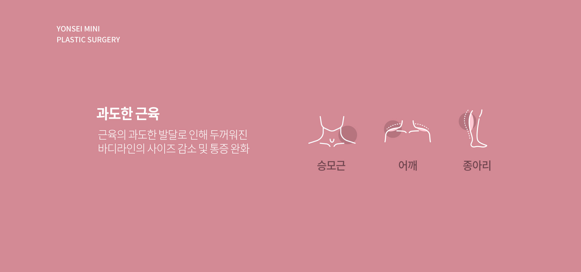 과도한 근육 - 근육의 과도한 발달로 인해 두꺼워진 바디라인의 사이즈 감소 및 통증 완화. 승모근, 어깨, 종아리