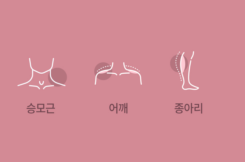  승모근, 어깨, 종아리