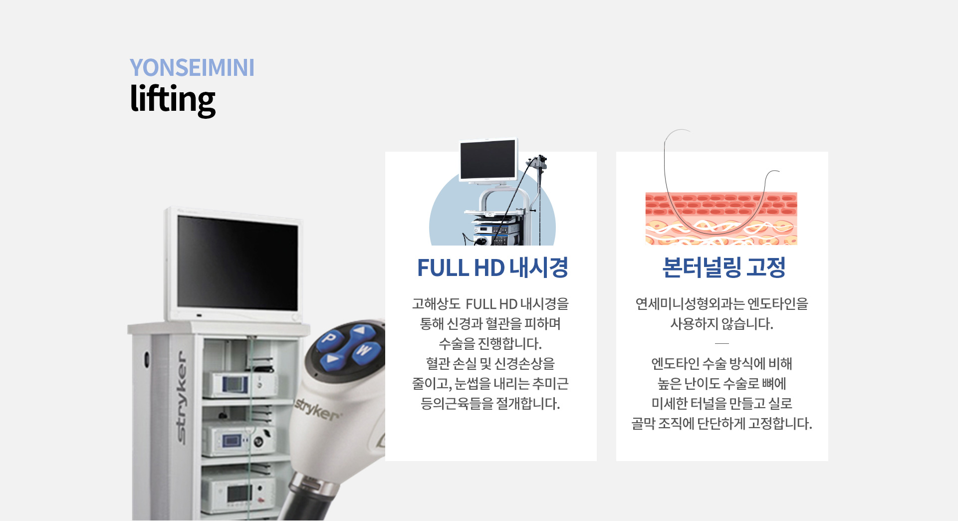 FULL HD 내시경 , 본터널링 고정