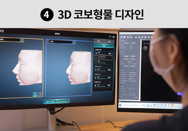 4. 3D 코보형물 디자인